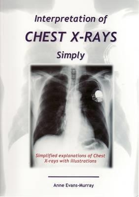 Interpretation of Chest X-Rays Simply - Click Image to Close