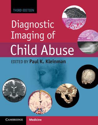 Diagnostic Imaging of Child Abuse - Click Image to Close