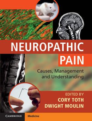 Neuropathic Pain: Causes, Management and Understanding - Click Image to Close