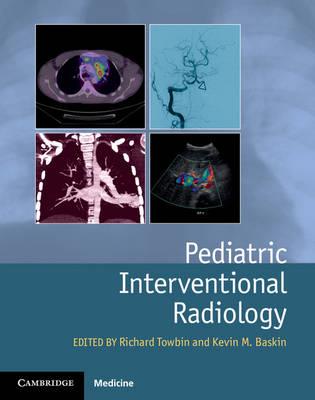 Pediatric Interventional Radiology - Click Image to Close
