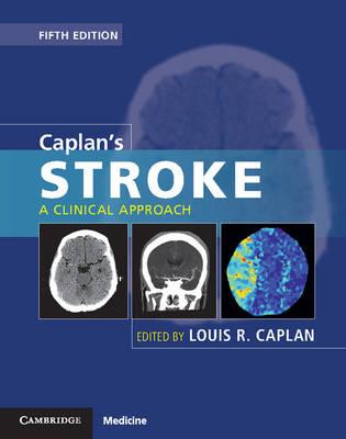 Caplan's Stroke: A Clinical Approach - Click Image to Close