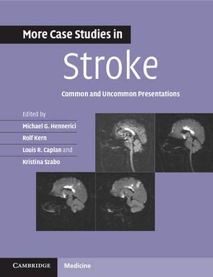 More Case Studies in Stroke: Common and Uncommon Presentations - Click Image to Close