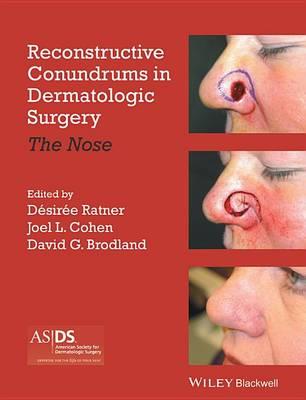 Reconstructive Conundrums in Dermatology: The Nose - Click Image to Close