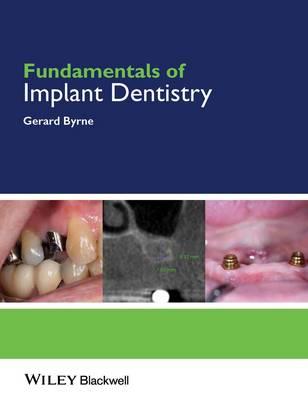 Fundamentals of Implant Dentistry - Click Image to Close