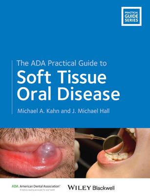 ADA Practical Guide to Soft Tissue Oral Disease, The - Click Image to Close