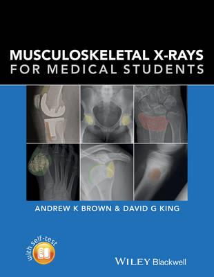 Musculoskeletal X-Rays for Medical Students - Click Image to Close