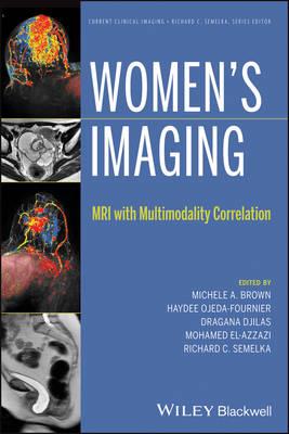 Women's Imaging: MRI with Multimodality Correlation - Click Image to Close