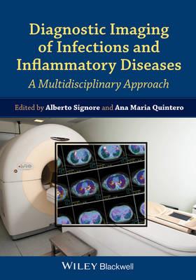 Diagnostic Imaging of Infections and Inflammatory Diseases: A Multidiscplinary Approach - Click Image to Close