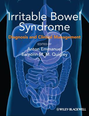 Irritable Bowel Syndrome: Diagnosis and Clinical Management - Click Image to Close