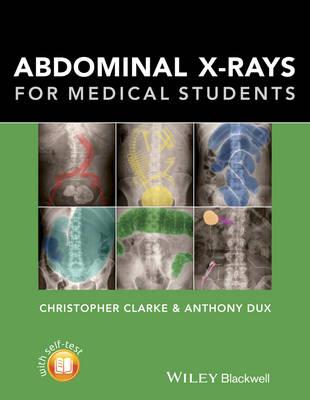 Abdominal X-Rays for Medical Students - Click Image to Close