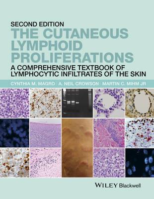 The Cutaneous Lymphoid Proliferations: A Comprehensive Textbook of Lymphocytic Infiltrates of the Skin - Click Image to Close