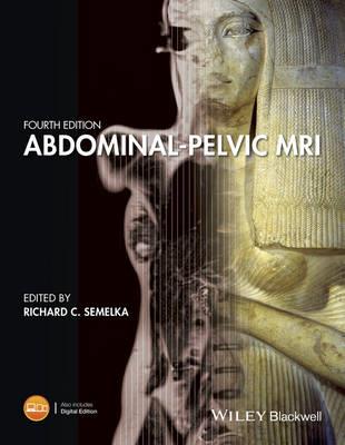 Abdominal-Pelvic MRI - Click Image to Close