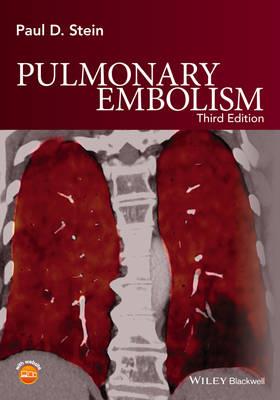 Pulmonary Embolism 3rd edition - Click Image to Close