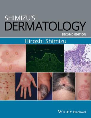 Shimizu's Dermatology 2nd edition - Click Image to Close