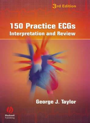 150 Practice ECGs: Interpretation and Review - Click Image to Close