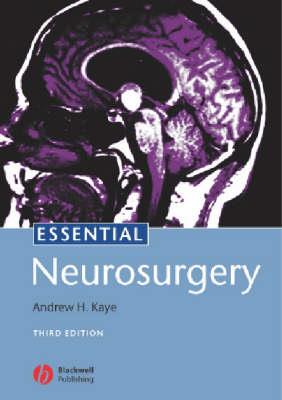 Essential Neurosurgery - Click Image to Close