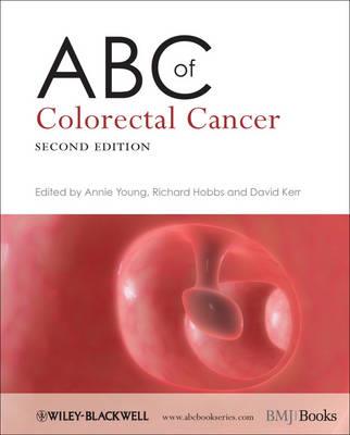 ABC of Colorectal Cancer - Click Image to Close