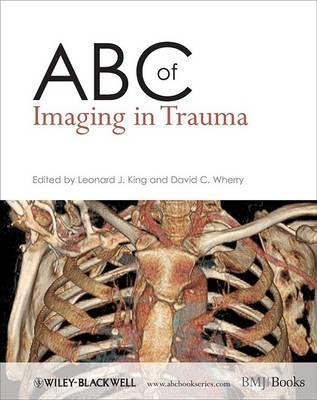 ABC of Imaging in Trauma - Click Image to Close