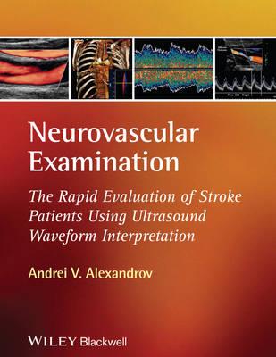 Neurovascular Examination: The Rapid Evaluation of Stroke Patients Using Ultrasound Waveform Interpretation - Click Image to Close