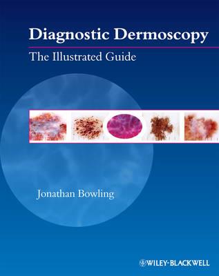 Diagnostic Dermoscopy: The Illustrated Guide - Click Image to Close