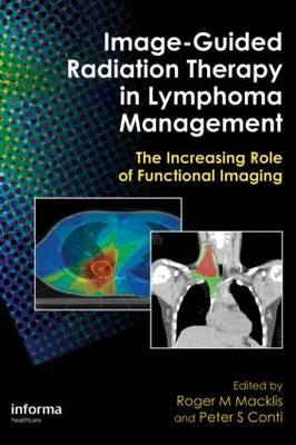 Image-Guided Radiation Therapy in Lymphoma Management - Click Image to Close