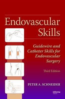 Endovascular Skills: Guidewire and Catheter Skills for Endovascular Surgery - Click Image to Close