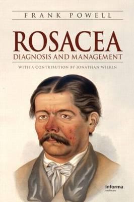 Rosacea - Click Image to Close