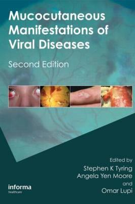 Mucocutaneous Manifestations of Viral Diseases - Click Image to Close
