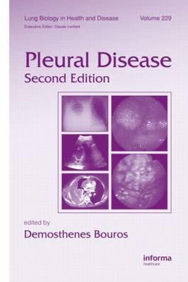 Pleural Disease - Click Image to Close