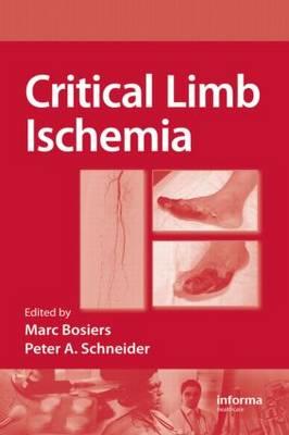 Critical Limb Ischemia - Click Image to Close