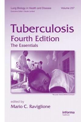 Tuberculosis - Click Image to Close