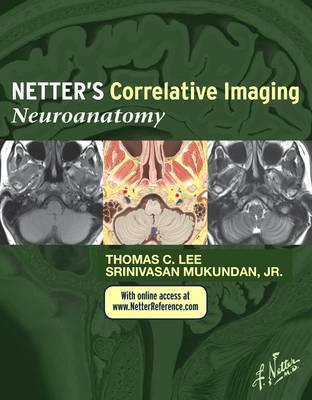 Netter's Correlative Imaging: Neuroanatomy - Click Image to Close