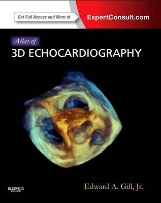 Atlas of 3D Echocardiography - Click Image to Close