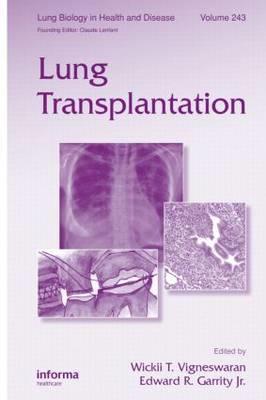 Lung Transplantation - Click Image to Close