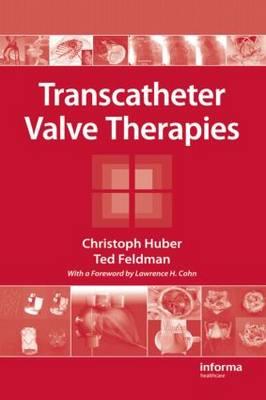 Transcatheter Valve Therapies - Click Image to Close