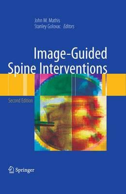 Image-Guided Spine Interventions - Click Image to Close