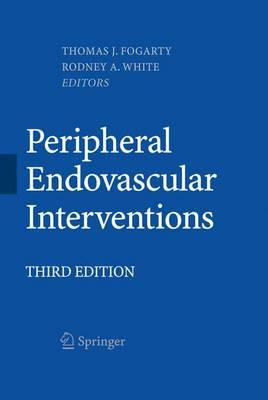 Peripheral Endovascular Interventions - Click Image to Close