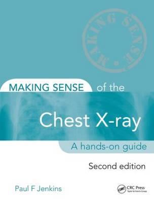 Making Sense of the Chest X-ray - Click Image to Close