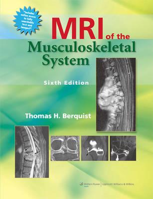 MRI of the Musculoskeletal System - Click Image to Close