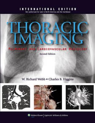 Thoracic Imaging: Pulmonary and Cardiovascular Radiology - Click Image to Close