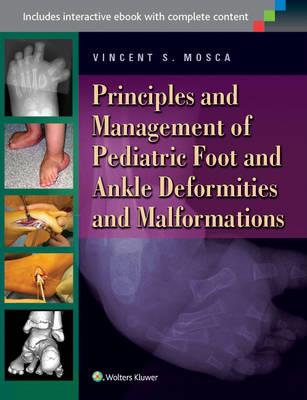 Principles and Management of Pediatric Foot and Ankle Deformities and Malformations - Click Image to Close