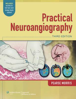 Practical Neuroangiography - Click Image to Close