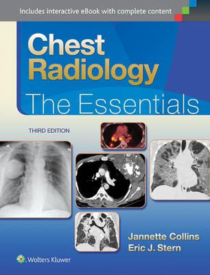 Chest Radiology: The Essentials - Click Image to Close