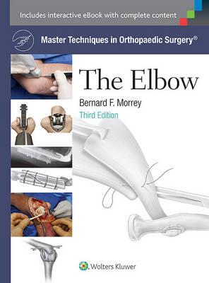 Master Techniques in Orthopaedic Surgery: The Elbow - Click Image to Close