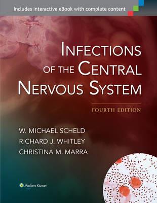 Infections of the Central Nervous System - Click Image to Close