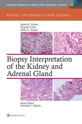 Biopsy Interpretation of the Kidney amp; Adrenal Gland - Click Image to Close
