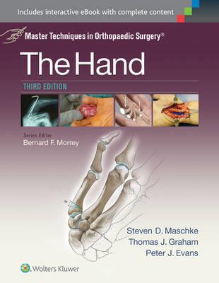 Master Techniques in Orthopaedic Surgery: The Hand - Click Image to Close