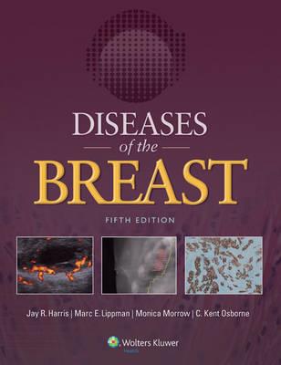 Diseases of the Breast - Click Image to Close