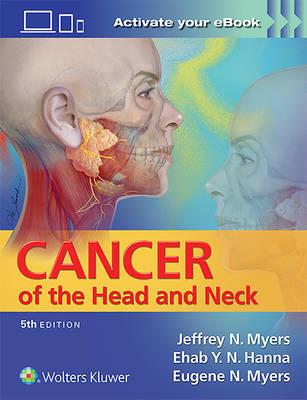 Cancer of the Head and Neck - Click Image to Close