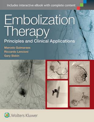 Embolization Therapy: Principles and Clinical Applications - Click Image to Close